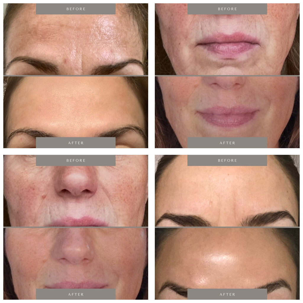 Die Anti-Aging Revolution