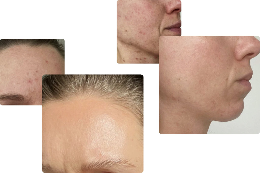 Im Vorher-Nachher-Vergleich