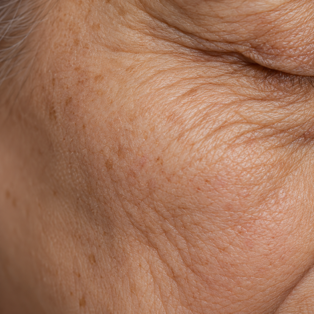Falten & Spannkraftverlust